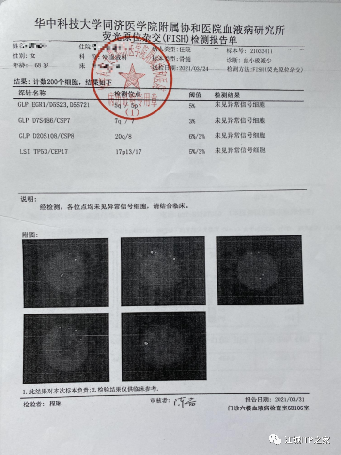 大咖谈病例 | 梅恒教授点评—肿瘤化疗后血小板减少症（CIT）病例解析-ITP家园