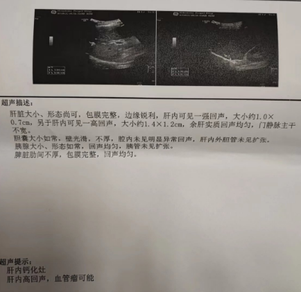 大咖谈病例 | 张敬宇教授：一例真性红细胞增多症的病例点评