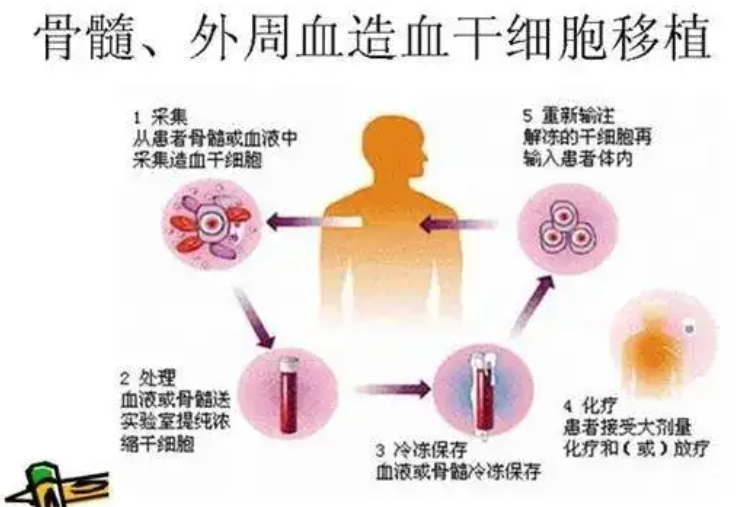 什么是造血干细胞?