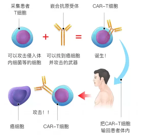 百万起步，CAR-T到底是何方神药？凭什么这么贵？疗效怎样？