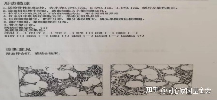 大咖谈病例 | 鹿全意教授：一例原发性血小板增多的病例点评